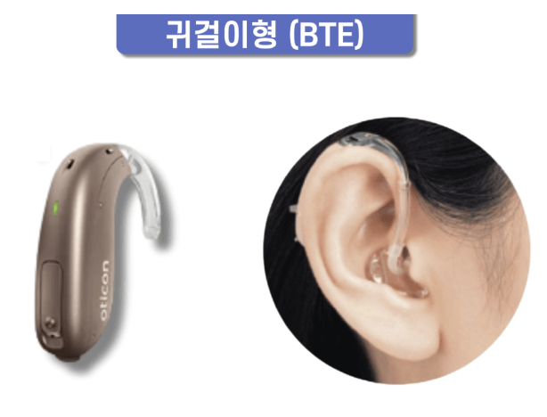 귀걸이형 보청기(BTE)